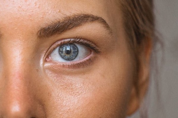 Conseils très utiles pour prendre soin d'une peau mixte